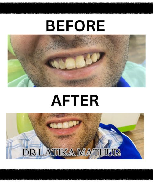 638514485244378831SMILE DESIGN 1