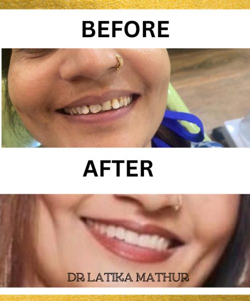 638514485520365500SMILE DESIGN 2